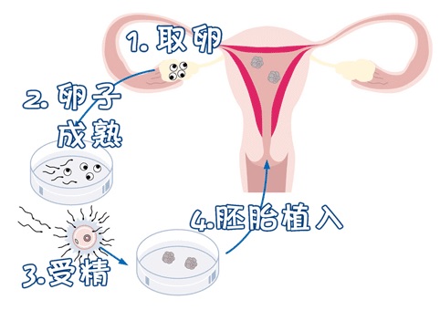 极光生殖